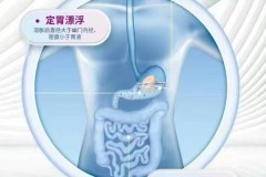 二甲双胍，我该怎么选？