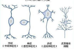 运动神经元病最新治疗方案
