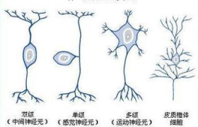 运动神经元病最新治疗方案